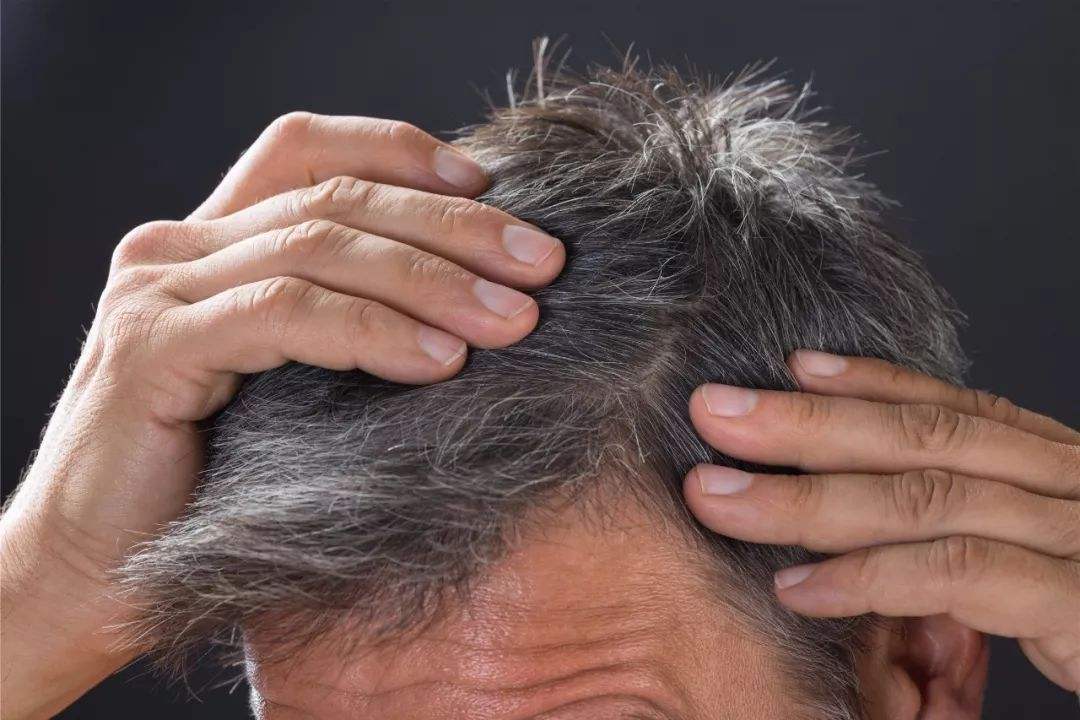 Gray hair is too old and what should I do if it grows?